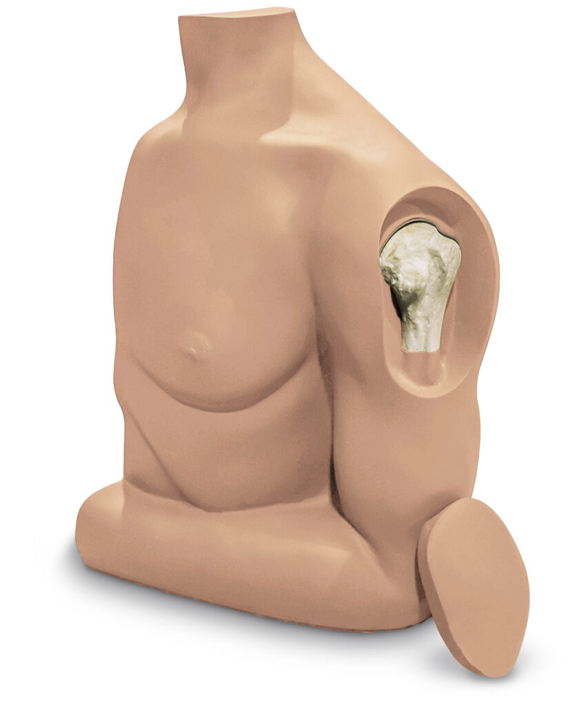 Manequim de intra ósseo no Umero