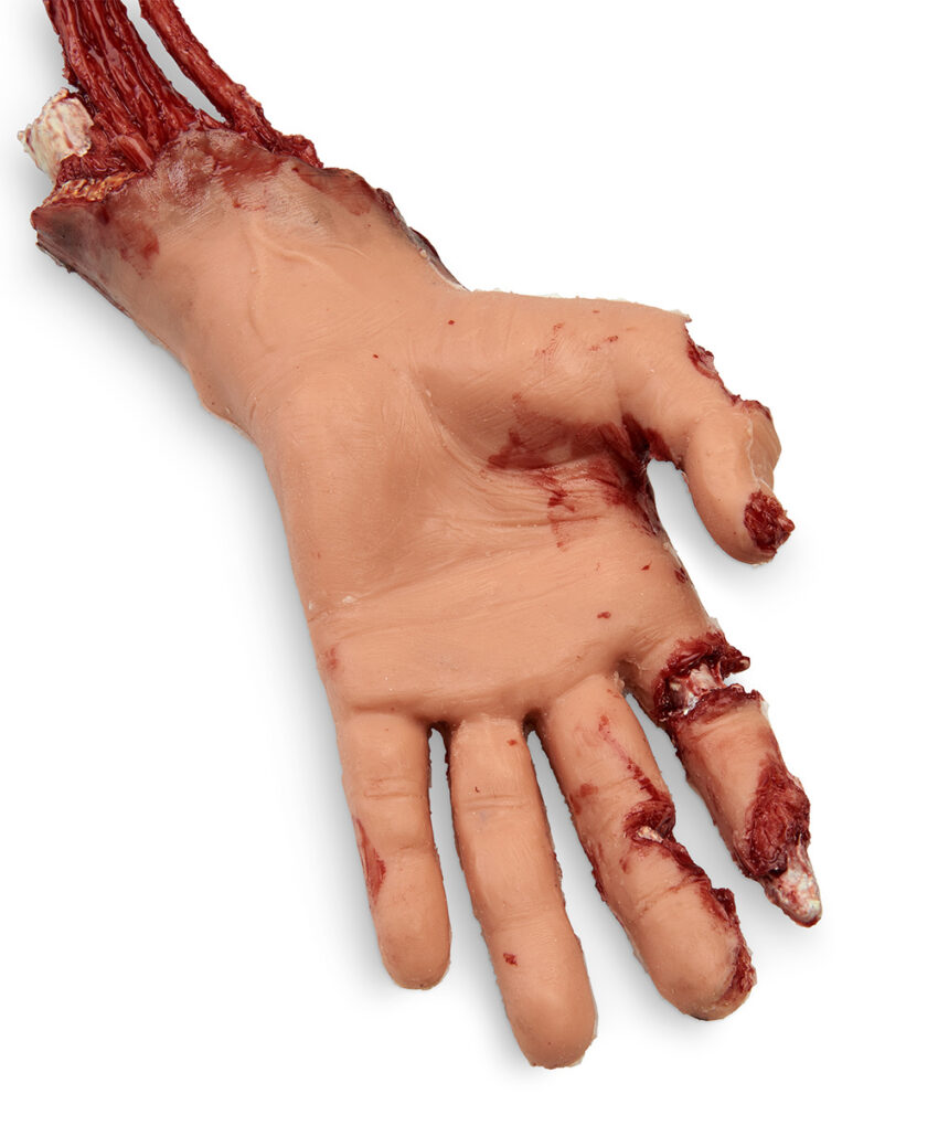 Alternative view of Braço com Sangramento Xtreme Trauma para SMART STAT