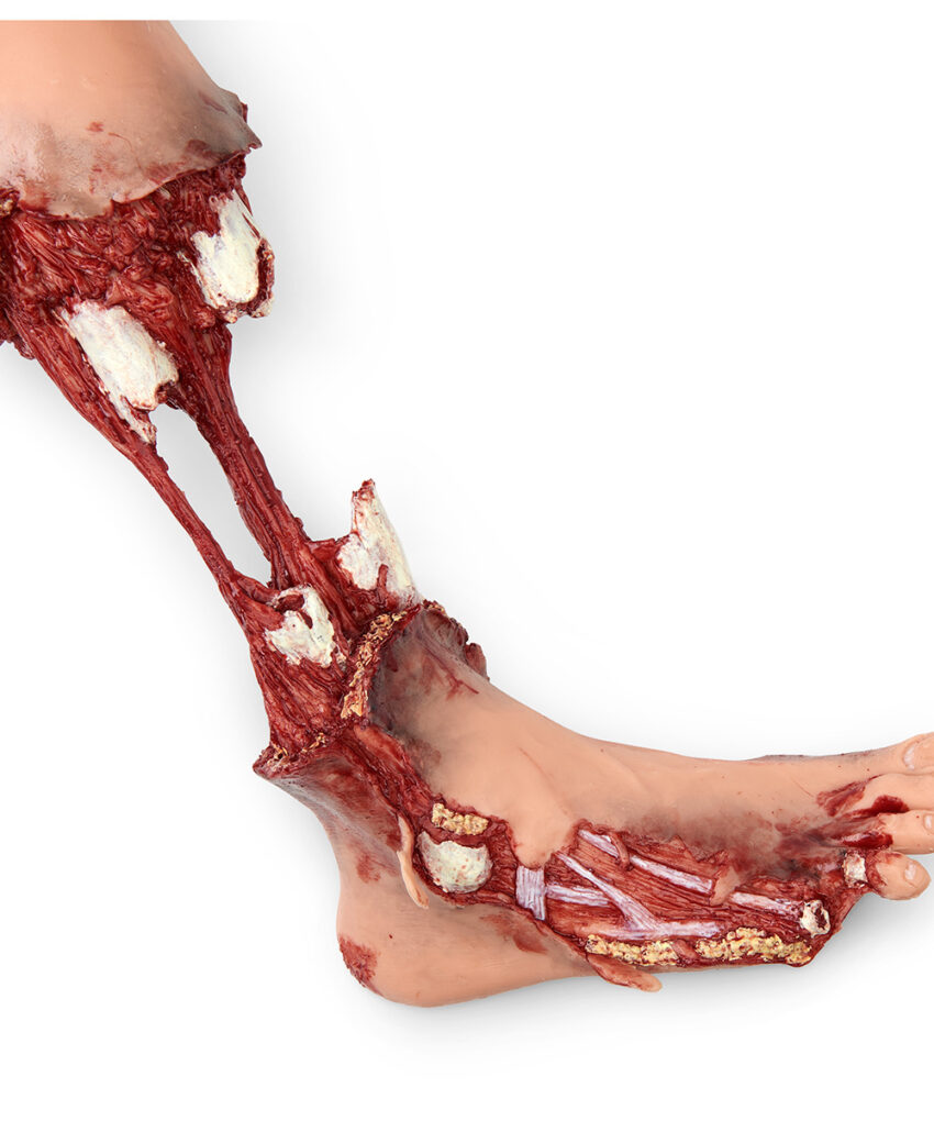 Simulador de ferimento para treinamento em Simuladores STAT