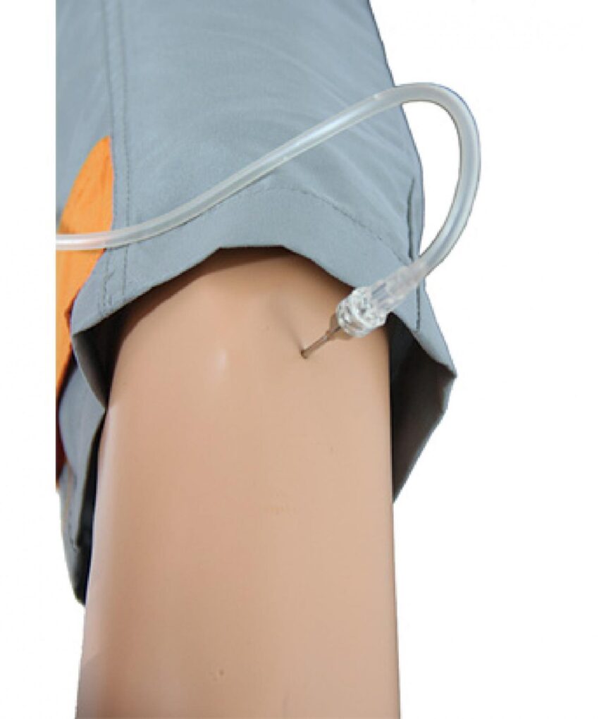 Alternative view of ACESSO AO KIT I.O,