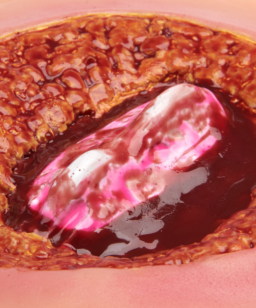 Alternative view of Simulaids Nursing and Technician Skills Kit