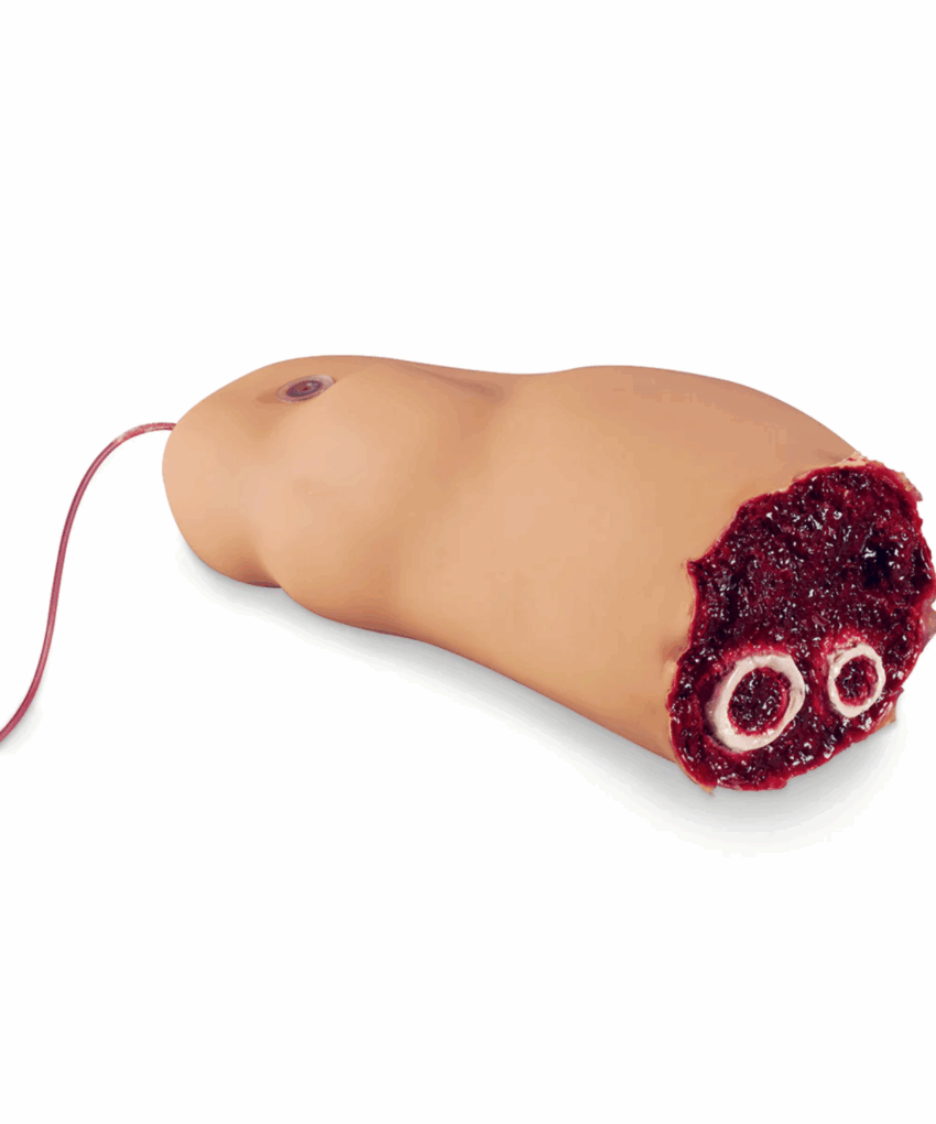 Perna amputada SMART STAT