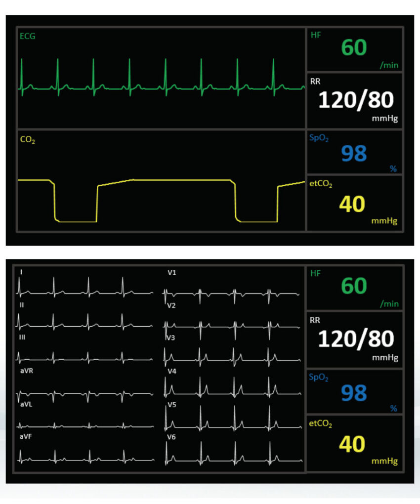 Alternative view of Ambu Man Advanced IV / 50-856