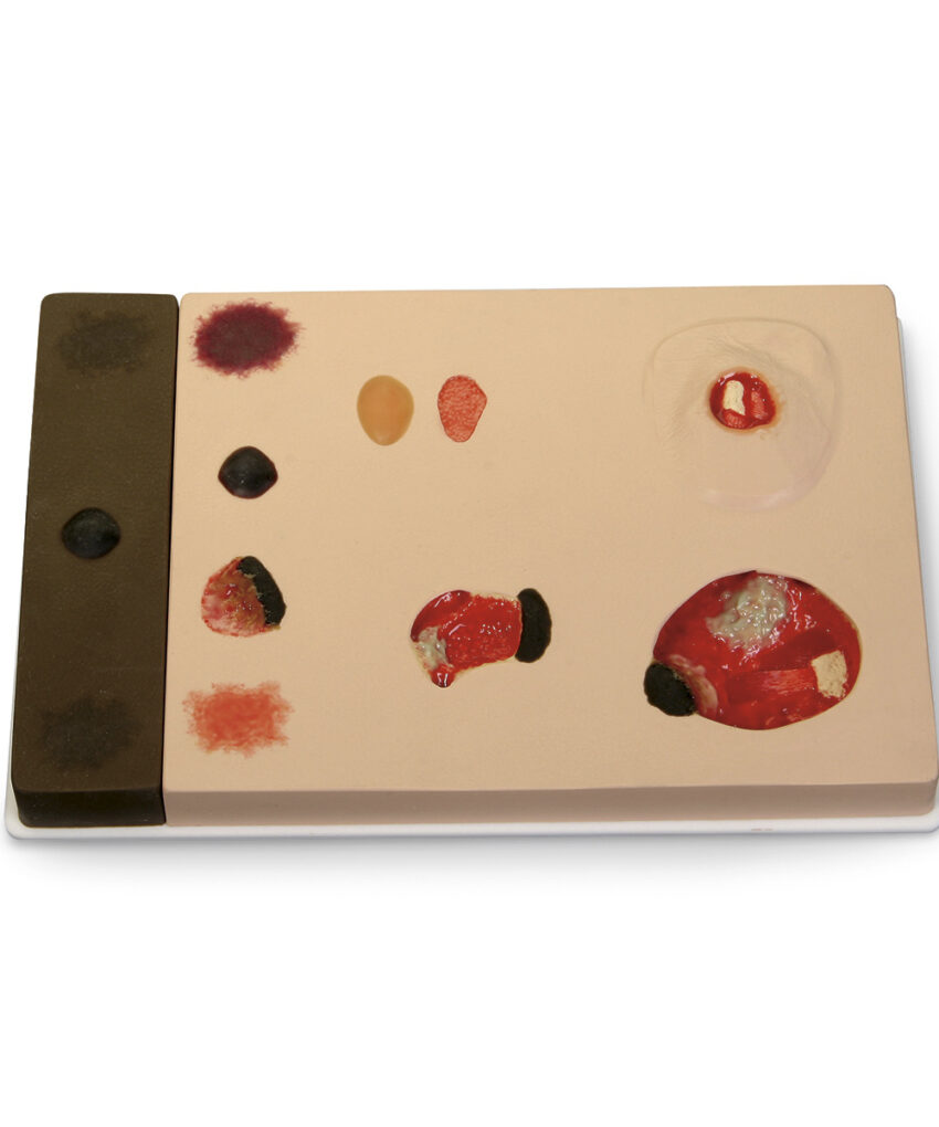 Pat Pressure Injury Staging Model™