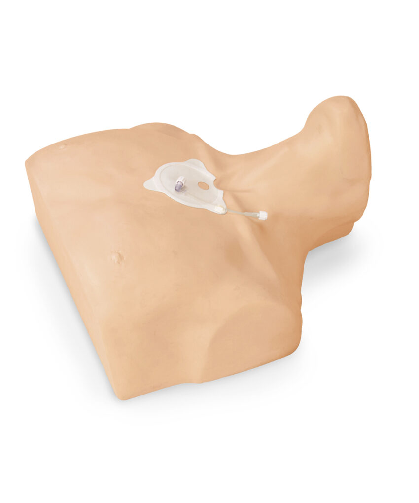 Alternative view of Simulador de infusão intra-óssea do esterno Adulto