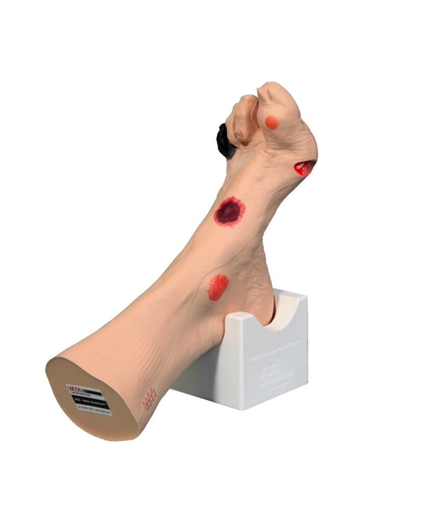 Alternative view of Wilma' Wound Foot™