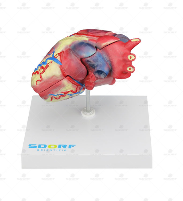 Alternative view of Modelo Patológico do Coração com Hipertrofia em 2 Partes