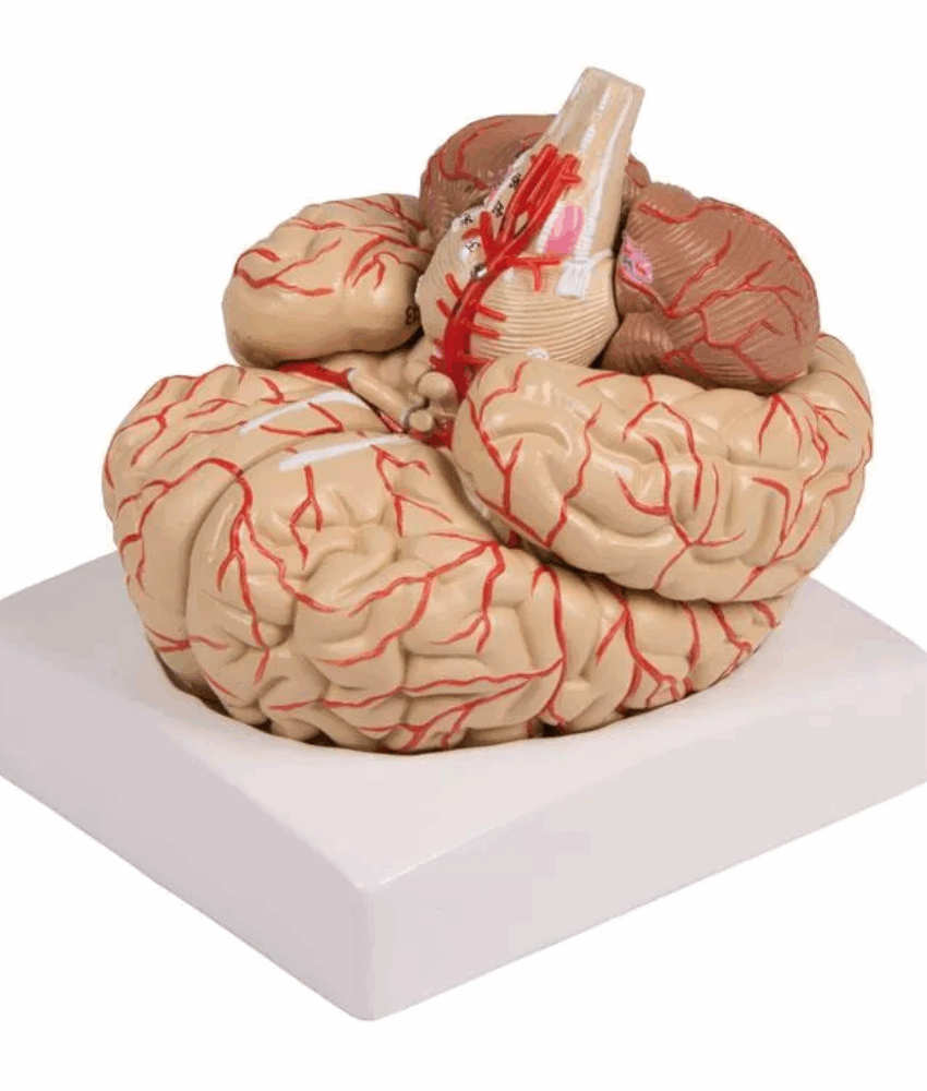 Modelo Cerebral com Artérias