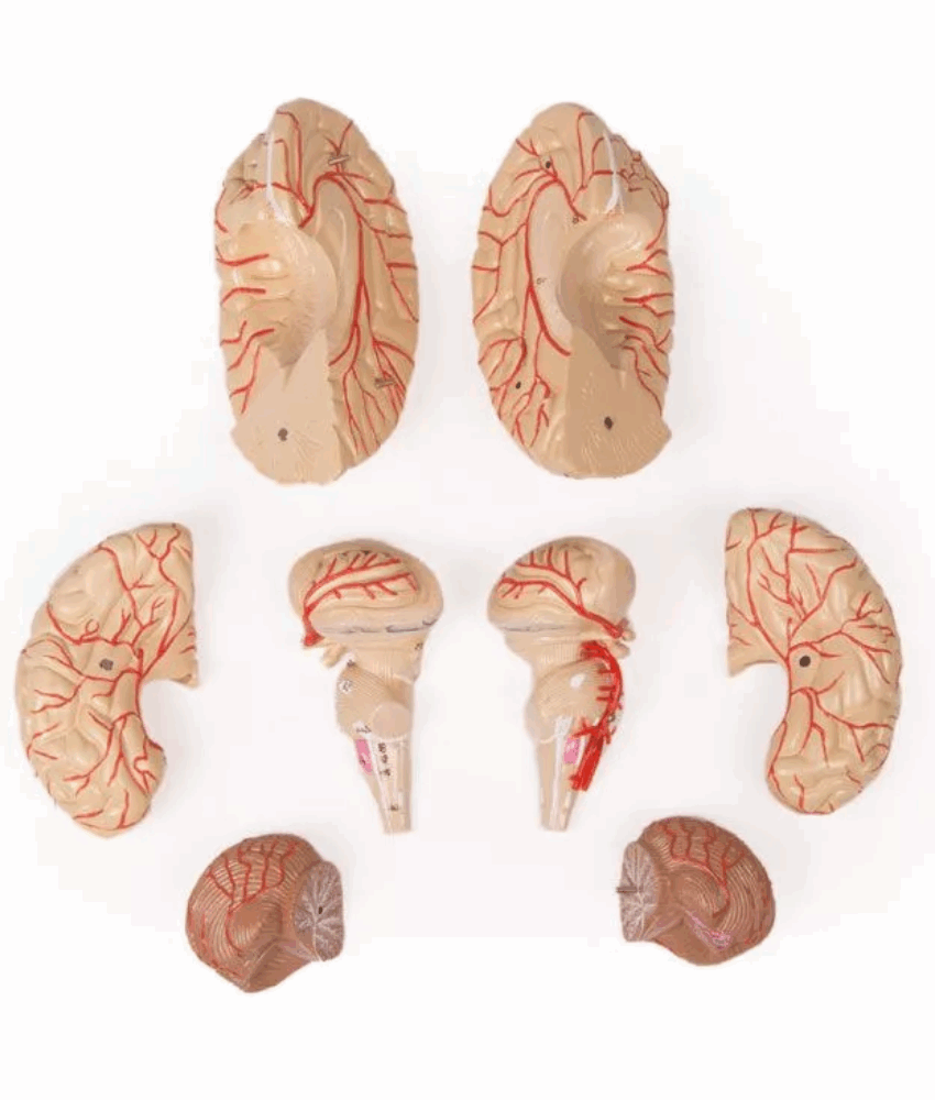 Alternative view of Modelo Cerebral com Artérias