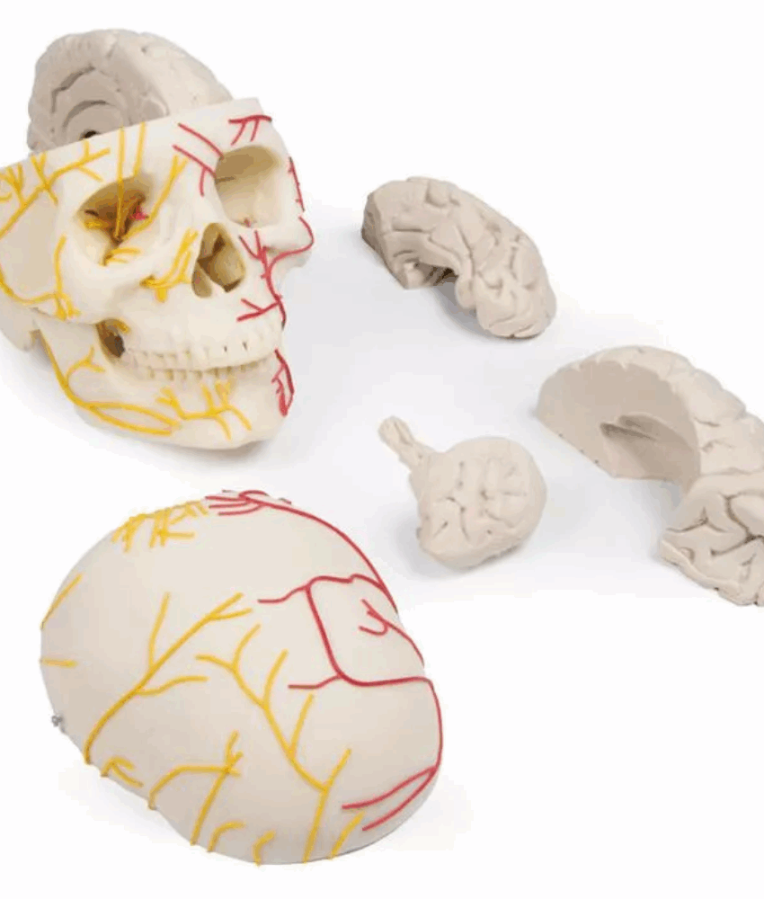 Modelo Neurovascular – Crânio com Cérebro 3 Partes