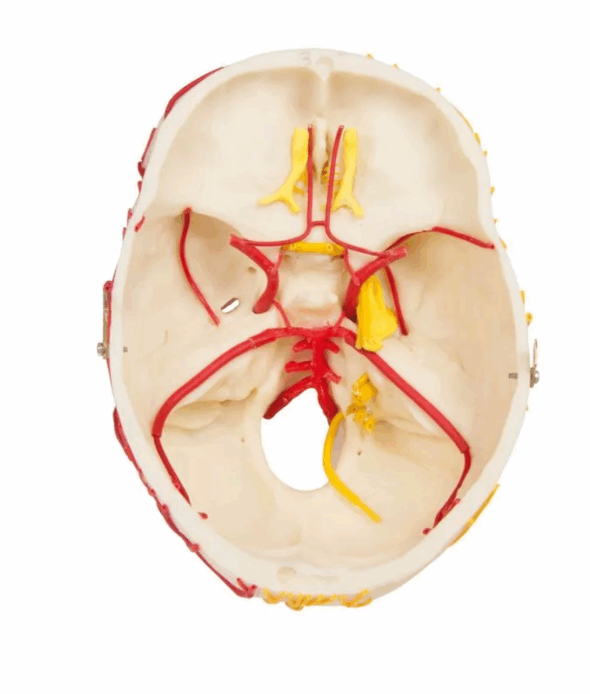 Alternative view of Modelo Neurovascular – Crânio com Cérebro 3 Partes