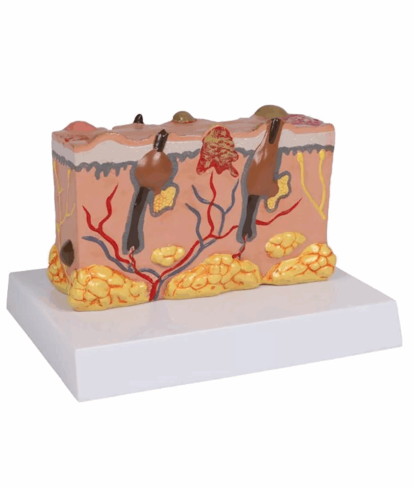 Alternative view of Modelo de Pele Patológica – 30× Tamanho Natural