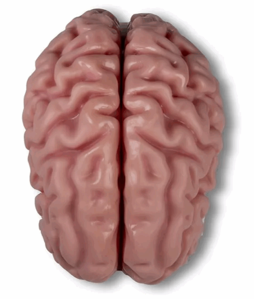 Alternative view of Modelo Anatômico de Cérebro – Tamanho Real, 5 Partes