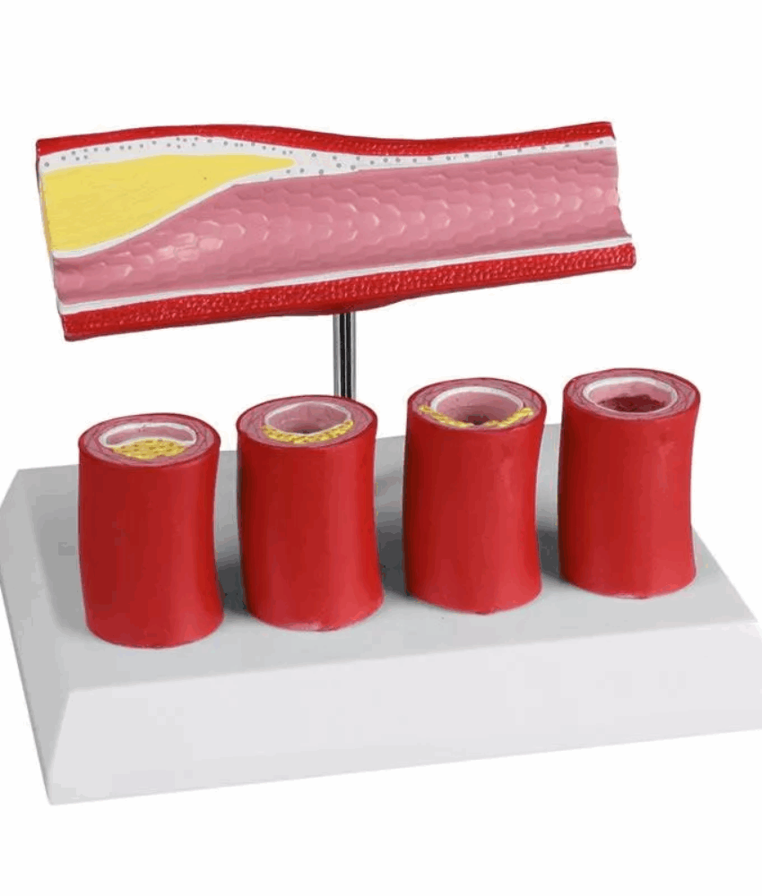 Artéria com 4 Seções – EZ Augmented Anatomy