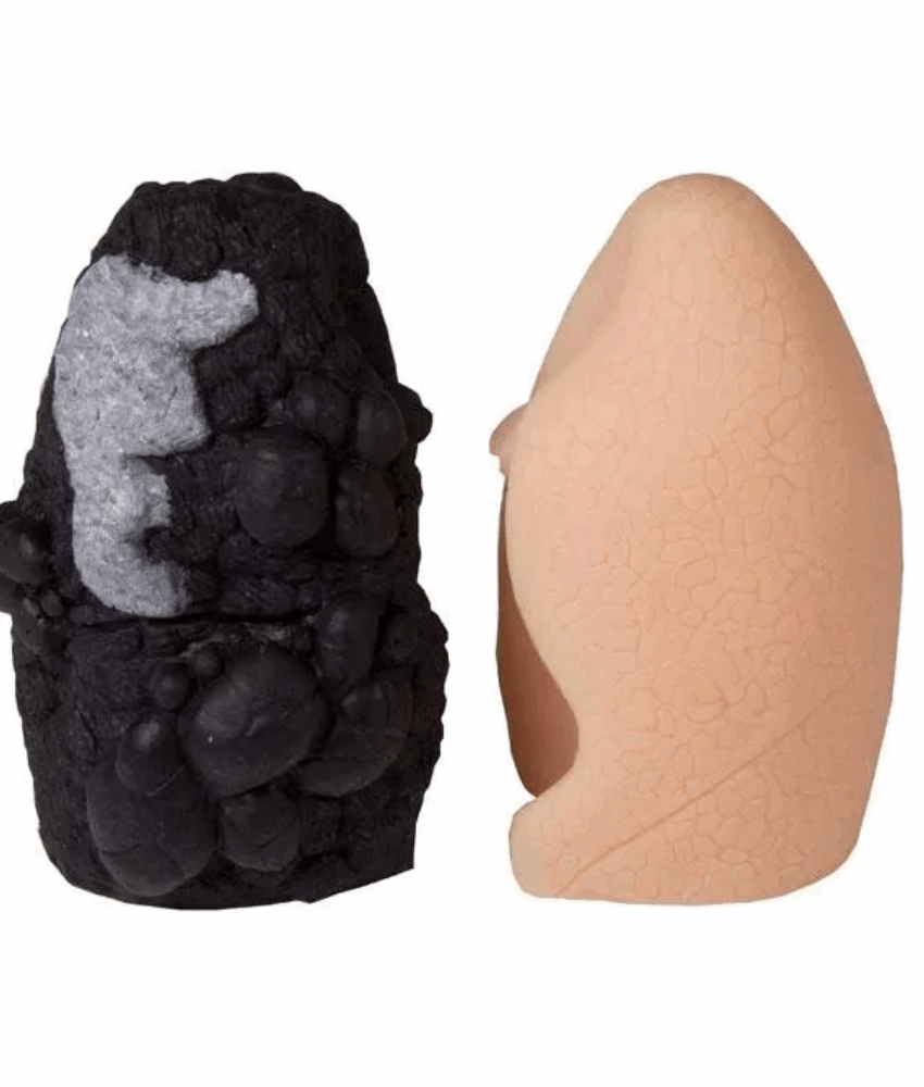 Modelo Anatômico de Comparação de Pulmões