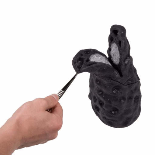 Modelo Anatômico de Pulmão com Câncer