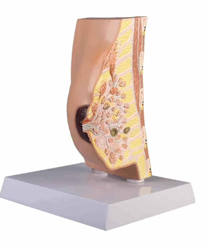 Modelo Anatômico de Seção Transversal da Mama com Doenças