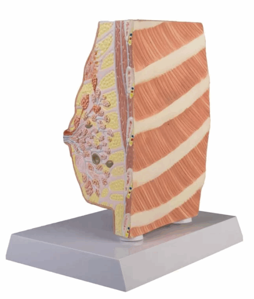 Alternative view of Modelo Anatômico de Seção Transversal da Mama com Doenças