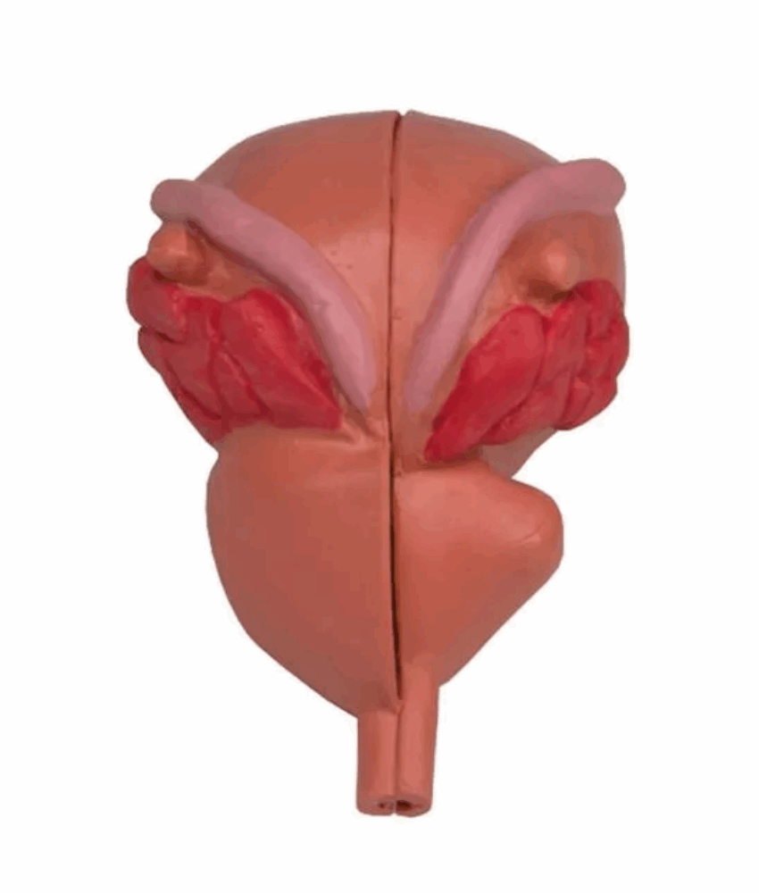 Alternative view of Modelo de Próstata – 2 Partes