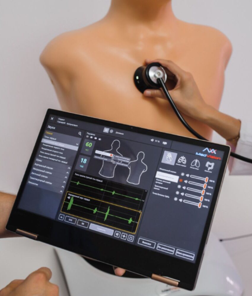 Alternative view of MATT